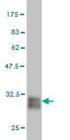 Antibody Reactive Against Recombinant Protein.Western Blot detection against Immunogen (31.83 KDa) . 
