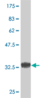 Antibody Reactive Against Recombinant Protein.Western Blot detection against Immunogen (36.52 KDa) . 