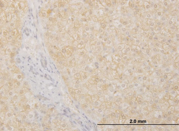 Immunoperoxidase of monoclonal antibody to POMGNT1 on formalin-fixed paraffin-embedded human liver. [antibody concentration 3 ug/ml]