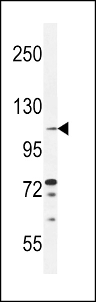 TLL2 Antibody (Center) (Cat. #AP11319c) western blot analysis in ZR-75-1 cell line lysates (35ug/lane).This demonstrates the TLL2 antibody detected the TLL2 protein (arrow).