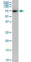 PLS1 monoclonal antibody (M04), clone 3G10. Western Blot analysis of PLS1 expression in Jurkat ( (Cat # AT3347a )