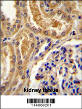 TLL2 Antibody (Center) (Cat. #AP11319c)immunohistochemistry analysis in formalin fixed and paraffin embedded human kidney tissue followed by peroxidase conjugation of the secondary antibody and DAB staining.This data demonstrates the use of TLL2 Antibody (Center) for immunohistochemistry. Clinical relevance has not been evaluated.