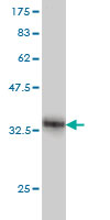 Antibody Reactive Against Recombinant Protein.Western Blot detection against Immunogen (35.64 KDa) . 