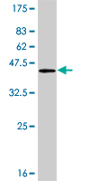 Antibody Reactive Against Recombinant Protein.Western Blot detection against Immunogen (36.63 KDa) . 