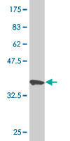 Antibody Reactive Against Recombinant Protein.Western Blot detection against Immunogen (36.63 KDa) . 