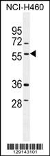 TSNARE1 Antibody (C-term) (Cat. #AP11310b) western blot analysis in NCI-H460 cell line lysates (35ug/lane).This demonstrates the TSNARE1 antibody detected the TSNARE1 protein (arrow).