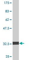 Antibody Reactive Against Recombinant Protein.Western Blot detection against Immunogen (33.33 KDa) . 