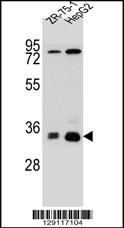 MTHFD2L Antibody (C-term) (Cat. #AP11306b) western blot analysis in HepG2,ZR-75-1 cell line lysates (35ug/lane).This demonstrates the MTHFD2L antibody detected the MTHFD2L protein (arrow).