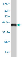 Antibody Reactive Against Recombinant Protein.Western Blot detection against Immunogen (36.01 KDa) . 