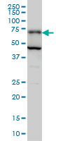 PGM2 monoclonal antibody (M05), clone 1A3 Western Blot analysis of PGM2 expression in Hela S3 NE ( (Cat # AT3283a )