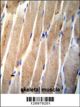 CLEC4F Antibody (C-term) (Cat. #AP11289b)immunohistochemistry analysis in formalin fixed and paraffin embedded human skeletal muscle followed by peroxidase conjugation of the secondary antibody and DAB staining.This data demonstrates the use of CLEC4F Antibody (C-term) for immunohistochemistry. Clinical relevance has not been evaluated.