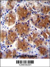 FAM108C1 Antibody (Center) (Cat. #AP11285c)immunohistochemistry analysis in formalin fixed and paraffin embedded human stomach tissue followed by peroxidase conjugation of the secondary antibody and DAB staining.This data demonstrates the use of FAM108C1 Antibody (Center) for immunohistochemistry. Clinical relevance has not been evaluated.