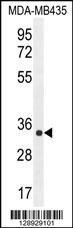 ALKBH6 Antibody (Center) (Cat. #AP11283c) western blot analysis in MDA-MB435 cell line lysates (35ug/lane).This demonstrates the ALKBH6 antibody detected the ALKBH6 protein (arrow).