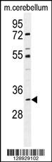 ALKBH6 Antibody (Center) (Cat. #AP11283c) western blot analysis in mouse cerebellum tissue lysates (35ug/lane).This demonstrates the ALKBH6 antibody detected the ALKBH6 protein (arrow).