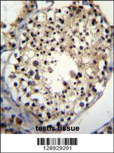 ALKBH6 Antibody (Center) (Cat. #AP11283c)immunohistochemistry analysis in formalin fixed and paraffin embedded human testis tissue followed by peroxidase conjugation of the secondary antibody and DAB staining.This data demonstrates the use of ALKBH6 Antibody (Center) for immunohistochemistry. Clinical relevance has not been evaluated.
