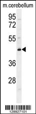 CYB5D2 Antibody (C-term) (Cat. #AP11281b) western blot analysis in mouse cerebellum tissue lysates (35ug/lane).This demonstrates the CYB5D2 antibody detected the CYB5D2 protein (arrow).