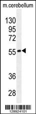 FAM69B Antibody (N-term) (Cat. #AP11279a) western blot analysis in mouse cerebellum tissue lysates (35ug/lane).This demonstrates the FAM69B antibody detected the FAM69B protein (arrow).