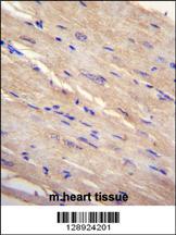 FAM69B Antibody (N-term) (Cat. #AP11279a)immunohistochemistry analysis in formalin fixed and paraffin embedded human m.heart tissue followed by peroxidase conjugation of the secondary antibody and DAB staining.This data demonstrates the use of FAM69B Antibody (N-term) for immunohistochemistry. Clinical relevance has not been evaluated.