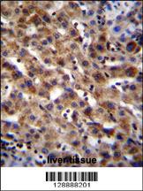 SPACA5B Antibody (N-term) (Cat. #AP11268a)immunohistochemistry analysis in formalin fixed and paraffin embedded human liver tissue followed by peroxidase conjugation of the secondary antibody and DAB staining.This data demonstrates the use of SPACA5B Antibody (N-term) for immunohistochemistry. Clinical relevance has not been evaluated.