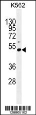 PRAMEF10 Antibody (C-term) (Cat. #AP11258b) western blot analysis in K562 cell line lysates (35ug/lane).This demonstrates the PRAMEF10 antibody detected the PRAMEF10 protein (arrow).