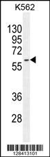 KRT73 Antibody (C-term) (Cat. #AP11248b) western blot analysis in K562 cell line lysates (35ug/lane).This demonstrates the KRT73 antibody detected the KRT73 protein (arrow).