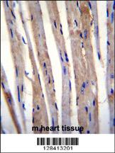 KRT73 Antibody (C-term) (Cat. #AP11248b)immunohistochemistry analysis in formalin fixed and paraffin embedded m.heart tissue followed by peroxidase conjugation of the secondary antibody and DAB staining.This data demonstrates the use of KRT73 Antibody (C-term) for immunohistochemistry. Clinical relevance has not been evaluated.