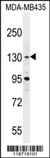 GLTSCR1 Antibody (Center) (Cat. #AP11219c) western blot analysis in MDA-MB435 cell line lysates (35ug/lane).This demonstrates the GLTSCR1 antibody detected the GLTSCR1 protein (arrow).
