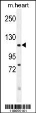 FBXO18 Antibody (C-term) (Cat. #AP11216b) western blot analysis in mouse heart tissue lysates (35ug/lane).This demonstrates the FBXO18 antibody detected the FBXO18 protein (arrow).