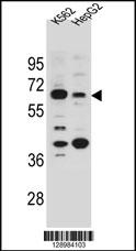 NHEDC1 Antibody (N-term) (Cat. #AP11182a) western blot analysis in K562 and HepG2 cell line lysates (35ug/lane).This demonstrates the NHEDC1 antibody detected the NHEDC1 protein (arrow).