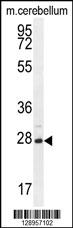 VSTM2A Antibody (Center) (Cat. #AP11175c) western blot analysis in mouse cerebellum tissue lysates (35ug/lane).This demonstrates the VSTM2A antibody detected the VSTM2A protein (arrow).