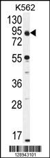 KLRAQ1 Antibody (Center) (Cat. #AP11169c) western blot analysis in K562 cell line lysates (35ug/lane).This demonstrates the KLRAQ1 antibody detected the KLRAQ1 protein (arrow).