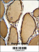 KLRAQ1 Antibody (Center) (Cat. #AP11169c)immunohistochemistry analysis in formalin fixed and paraffin embedded human thyroid tissue followed by peroxidase conjugation of the secondary antibody and DAB staining.This data demonstrates the use of KLRAQ1 Antibody (Center) for immunohistochemistry. Clinical relevance has not been evaluated.