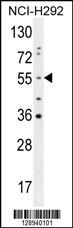 OTUD1 Antibody (Center) (Cat. #AP11168c) western blot analysis in NCI-H292 cell line lysates (35ug/lane).This demonstrates the OTUD1 antibody detected the OTUD1 protein (arrow).