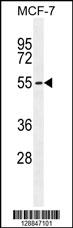 PMPCA Antibody (C-term) (Cat. #AP11161b) western blot analysis in MCF-7 cell line lysates (35ug/lane).This demonstrates the PMPCA antibody detected the PMPCA protein (arrow).
