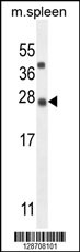 K1143 Antibody (N-term) (Cat. #AP11157a) western blot analysis in mouse spleen tissue lysates (35ug/lane).This demonstrates the K1143 antibody detected the K1143 protein (arrow).