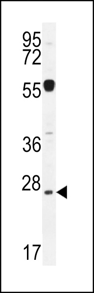 NPS3A Antibody (Center) (Cat. #AP11156c) western blot analysis in mouse liver tissue lysates (35ug/lane).This demonstrates the NPS3A antibody detected the NPS3A protein (arrow).