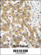NPS3A Antibody (Center) (Cat. #AP11156c)immunohistochemistry analysis in formalin fixed and paraffin embedded human liver tissue followed by peroxidase conjugation of the secondary antibody and DAB staining.This data demonstrates the use of NPS3A Antibody (Center) for immunohistochemistry. Clinical relevance has not been evaluated.