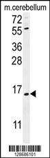 ANR39 Antibody (C-term) (Cat. #AP11153b) western blot analysis in mouse cerebellum tissue lysates (35ug/lane).This demonstrates the ANR39 antibody detected the ANR39 protein (arrow).