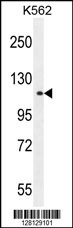 TDRD1 Antibody (C-term) (Cat. #AP11148b) western blot analysis in K562 cell line lysates (35ug/lane).This demonstrates the TDRD1 antibody detected the TDRD1 protein (arrow).