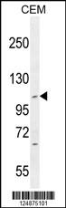 IFT88 Antibody (C-term) (Cat. #AP11138b) western blot analysis in CEM cell line lysates (35ug/lane).This demonstrates the IFT88 antibody detected the IFT88 protein (arrow).