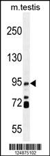 IFT88 Antibody (C-term) (Cat. #AP11138b) western blot analysis in mouse testis tissue lysates (35ug/lane).This demonstrates the IFT88 antibody detected the IFT88 protein (arrow).