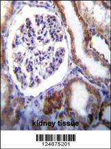 IFT88 Antibody (C-term) (Cat. #AP11138b)immunohistochemistry analysis in formalin fixed and paraffin embedded human kidney tissue followed by peroxidase conjugation of the secondary antibody and DAB staining.This data demonstrates the use of IFT88 Antibody (C-term) for immunohistochemistry. Clinical relevance has not been evaluated.