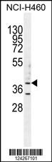 B3GALT5 Antibody (N-term) (Cat. #AP11135a) western blot analysis in NCI-H460 cell line lysates (35ug/lane).This demonstrates the B3GALT5 antibody detected the B3GALT5 protein (arrow).