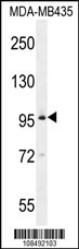 BRDT N-term (Cat. #AP7115a) western blot analysis in MDA-MB435 cell line lysates (35ug/lane).This demonstrates the BRDT antibody detected the BRDT protein (arrow).