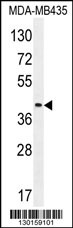 LILRA5 Antibody (N-term) (Cat. #AP11643a) western blot analysis in MDA-MB435 cell line lysates (35ug/lane).This demonstrates the LILRA5 antibody detected the LILRA5 protein (arrow).