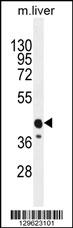 CACNG8 Antibody (N-term) (Cat. #AP11619a) western blot analysis in mouse liver tissue lysates (35ug/lane).This demonstrates the CACNG8 antibody detected the CACNG8 protein (arrow).