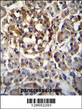 SEC14L5 Antibody (Center) (Cat. #AP11616c)immunohistochemistry analysis in formalin fixed and paraffin embedded human pancreas tissue followed by peroxidase conjugation of the secondary antibody and DAB staining.This data demonstrates the use of SEC14L5 Antibody (Center) for immunohistochemistry. Clinical relevance has not been evaluated.