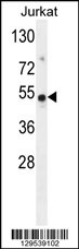 FAM118B Antibody (Center) (Cat. #AP11613c) western blot analysis in Jurkat cell line lysates (35ug/lane).This demonstrates the FAM118B antibody detected the FAM118B protein (arrow).
