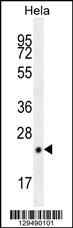 CPSF4L Antibody (C-term) (Cat. #AP11610b) western blot analysis in Hela cell line lysates (35ug/lane).This demonstrates the CPSF4L antibody detected the CPSF4L protein (arrow).