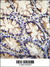 ECT2L Antibody (C-term) (Cat. #AP11601b)immunohistochemistry analysis in formalin fixed and paraffin embedded human rectum tissue followed by peroxidase conjugation of the secondary antibody and DAB staining.This data demonstrates the use of ECT2L Antibody (C-term) for immunohistochemistry. Clinical relevance has not been evaluated.